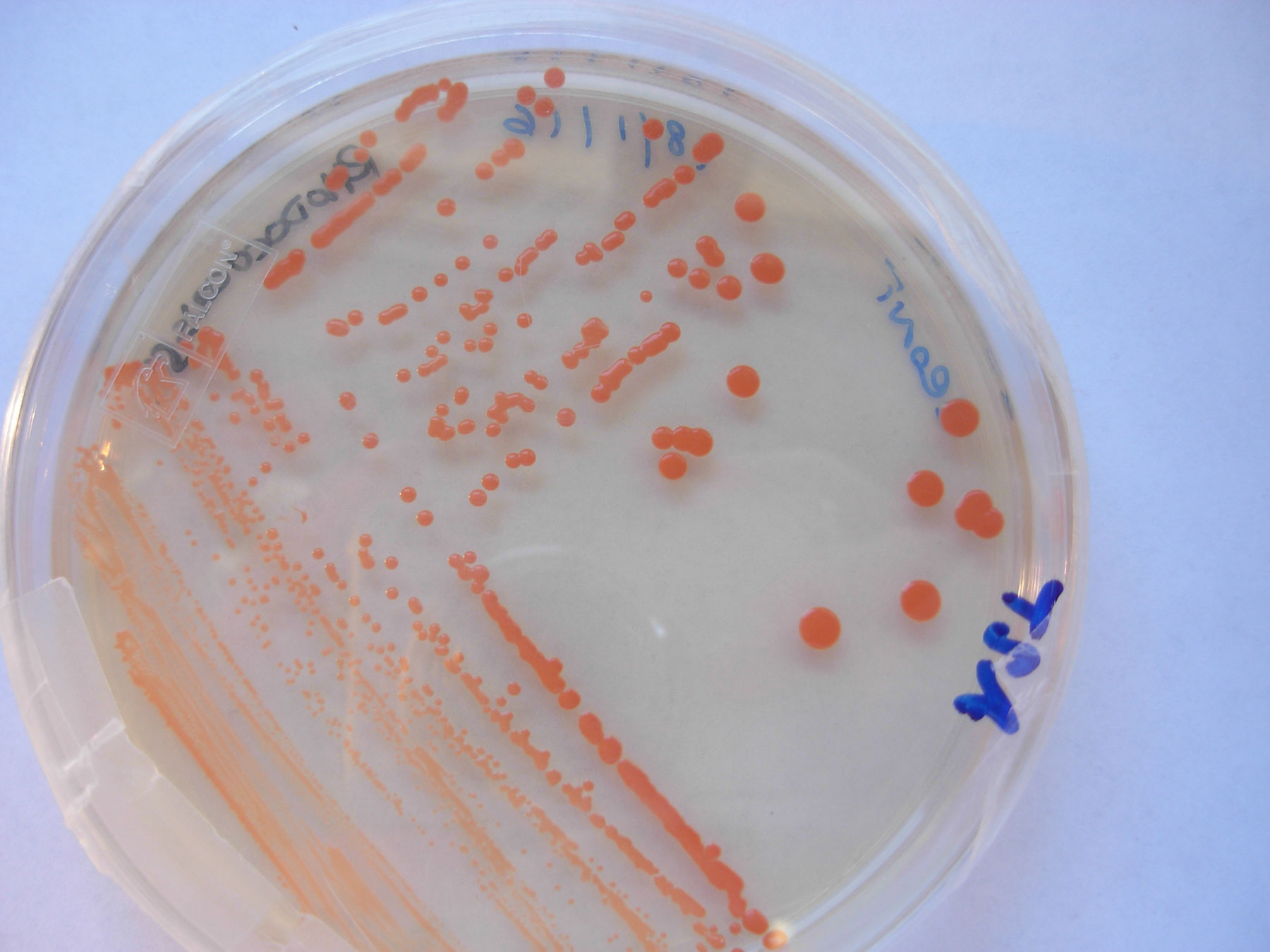 Colonie di ceppi batterici utilizzate sulle sculture di Michelangelo della Sagrestia Nuova delle Cappelle Medicee. Nome scientifico: Rhodococcus sp.Z-CONT - Foto per gentile concessione di ENEA

