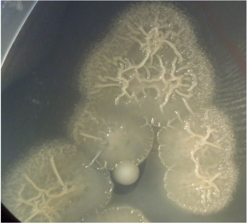 Colonie di ceppi batterici utilizzate sulle sculture di Michelangelo della Sagrestia Nuova delle Cappelle Medicee. Nome scientifico: Pseudomonas stutzeri CONC11 - Foto per gentile concessione di ENEA
