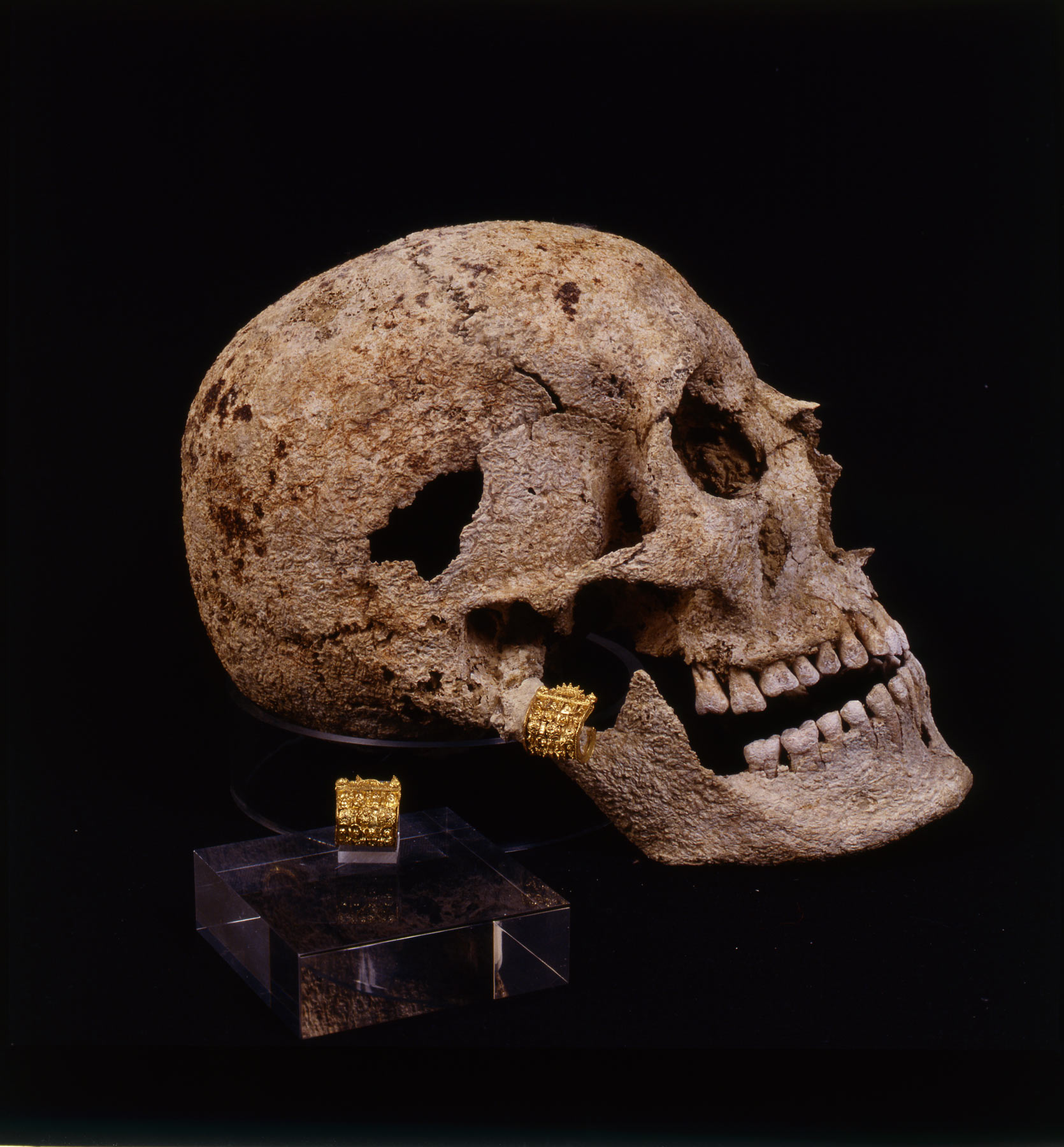 Skull of the Porciglia Girl with earring